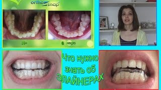 Элайнеры OrthoSnap 5 и 6 пара капп. Что нужно знать о лечении в элайнерах. Обзор клиники Сан Марко(Что нужно знать о лечении в элайнерах. Делюсь опытом исправления прикуса зубов с помощью элайнеров Orthosnap..., 2016-05-25T17:03:38.000Z)