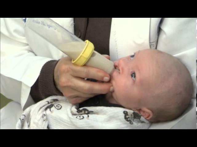 SpecialNeeds Feeder, Baby with cleft palate, Hospital use