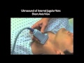 Ultrasound guidance for central venous access part 1