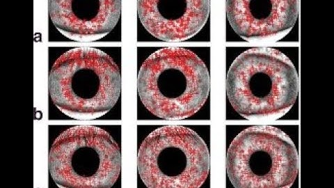 key points based feature extraction method for iris recognition - different image quality conditions
