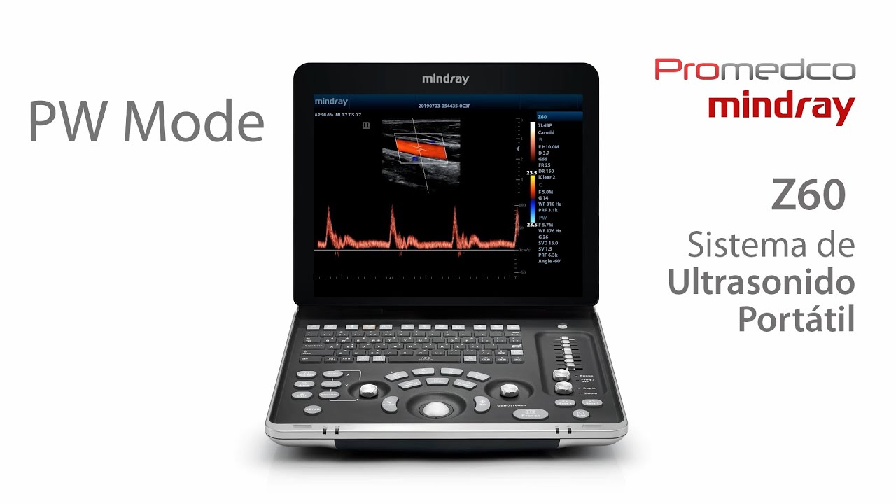 Z60 | Sistema de Ultrasonido Portátil Mindray