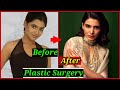 Shocking plastic surgery of south indian actresses  samantha akkineni kajal aggarwal anushka
