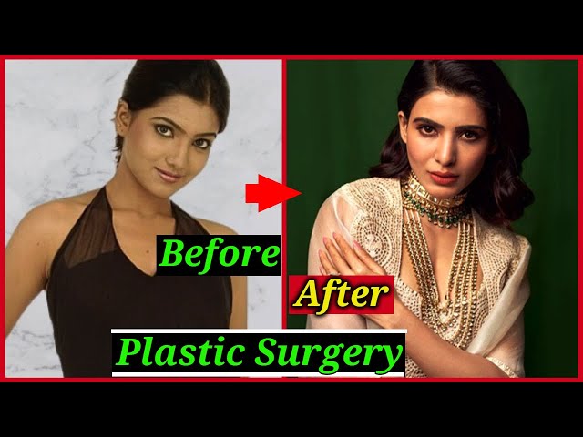 Shocking Plastic Surgery of South Indian Actresses | Samantha Akkineni, Kajal Aggarwal, Anushka class=