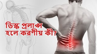 ডিস্ক প্রলাপ্স কি, কেন হয়, ডিস্ক প্রলাপ্সের লক্ষণ ও চিকিৎসা পদ্ধতি