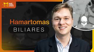 Hamartomas Biliares: Saiba Como Reconhecer no Ultrassom