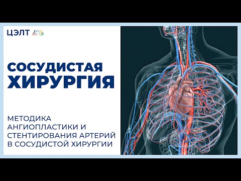 Video: Razlika Između Angiograma I Angioplastike