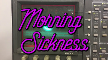 Scanimate Files 20171028