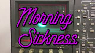 Scanimate Files 20171028