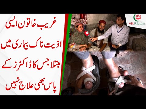 Ghareeb Khatoon aisi aziyat naak bimari mei mubtala jiska Doctors k pas bhi ilaaj nahi
