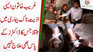 Ghareeb Khatoon aisi aziyat naak bimari mei mubtala jiska Doctors k pas bhi ilaaj nahi
