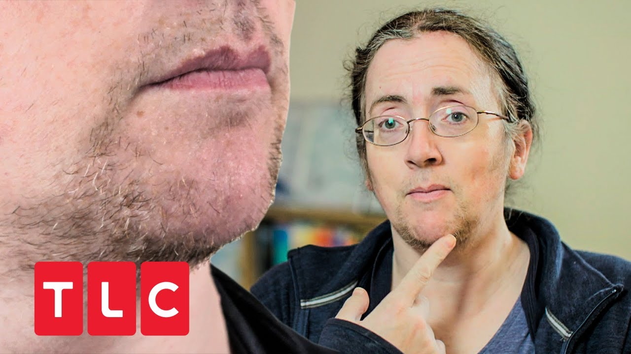 Bartwuchs als Frau! | Dr. Emma: Hautärztin aus Leidenschaft | TLC Deutschland