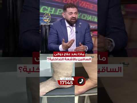 هل التغيرات بالجلد والقرح الوريدية بتتعافى بعد علاج دوالى الساقين بالأشعة التداخلية