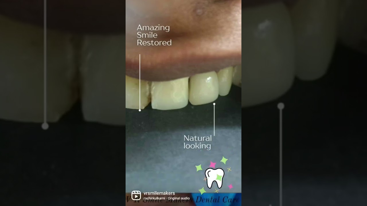 Perfect Smile.....Perfect Dentist.....Welcome to V R Smile Makers .We want everybody to smile free 😇