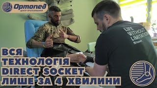 Вся технологія Дірект Сокет (Direct Socket) від Ossur (Össur) за 4 хвилини | Протезування військових