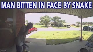 Man speaks out after being bitten in the face by snake