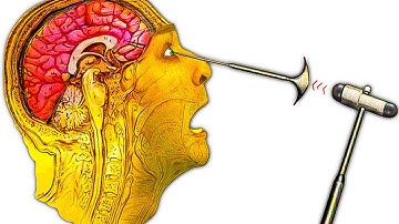 5 Creepy Ancient Medical Procedures