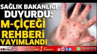 Sağlık Bakanlığı M çiçeği MPOX rehberi yayımladı Sağlık Bakanlığı, dünyada hızla yayılım gösteren ma