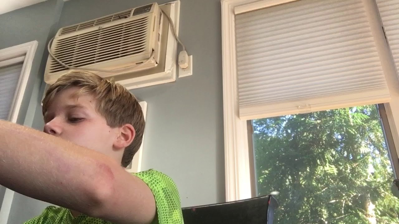 How to make homemade grills for teeth YouTube