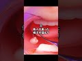 10秒でわかる！潔癖症診断✨️👩‍⚕️　#asmr