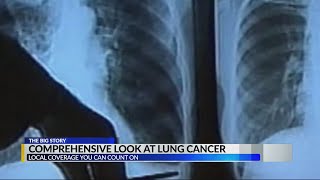Lung cancer: a comprehensive look