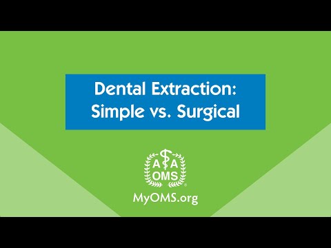 Dental Extraction: Simple vs. Surgical Dental Extraction: Simple vs. Surgical