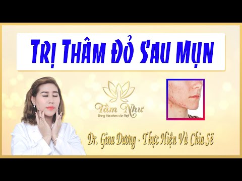 Trị Thâm Đỏ Sau Mụn/dr.gina dương