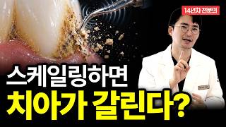 스케일링 후 치아가 벌어지고 시린 진짜 이유