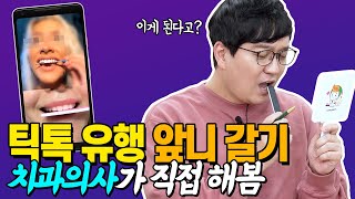 네일파일로 치아를 갈아?! | 틱톡 유행 셀프치아교정의 위험성