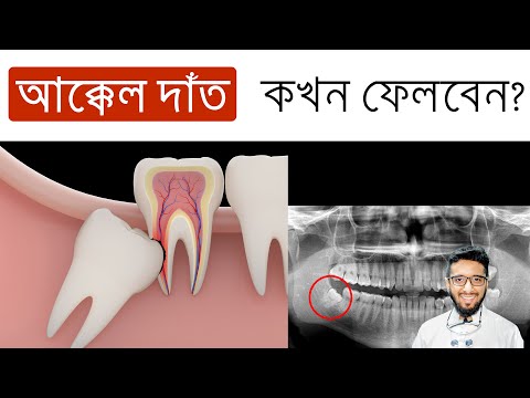 ভিডিও: বিড়ালছানা দাঁত কখন পরিবর্তন করে?