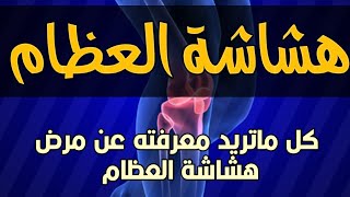 ما هي هشاشة العظام ؟ الوقاية والعلاج !