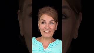 Gülüş Esteti̇ği̇ - Di̇ş Esteti̇ği̇ - Öncesi̇ Ve Sonrasi