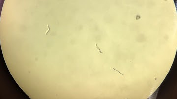 dpy-13 RNAi Treated C. Elegans