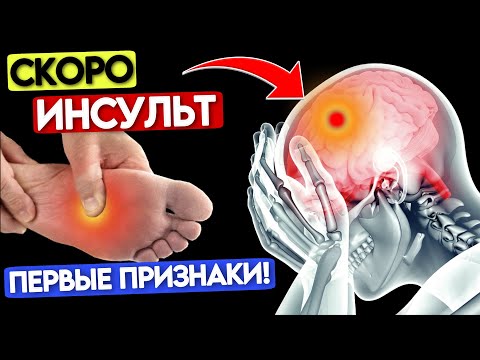 8 Признаков скорого ИНСУЛЬТА! Ваше Тело предупреждает вас… НЕ Пропусти - ВЫЖИВЕШЬ