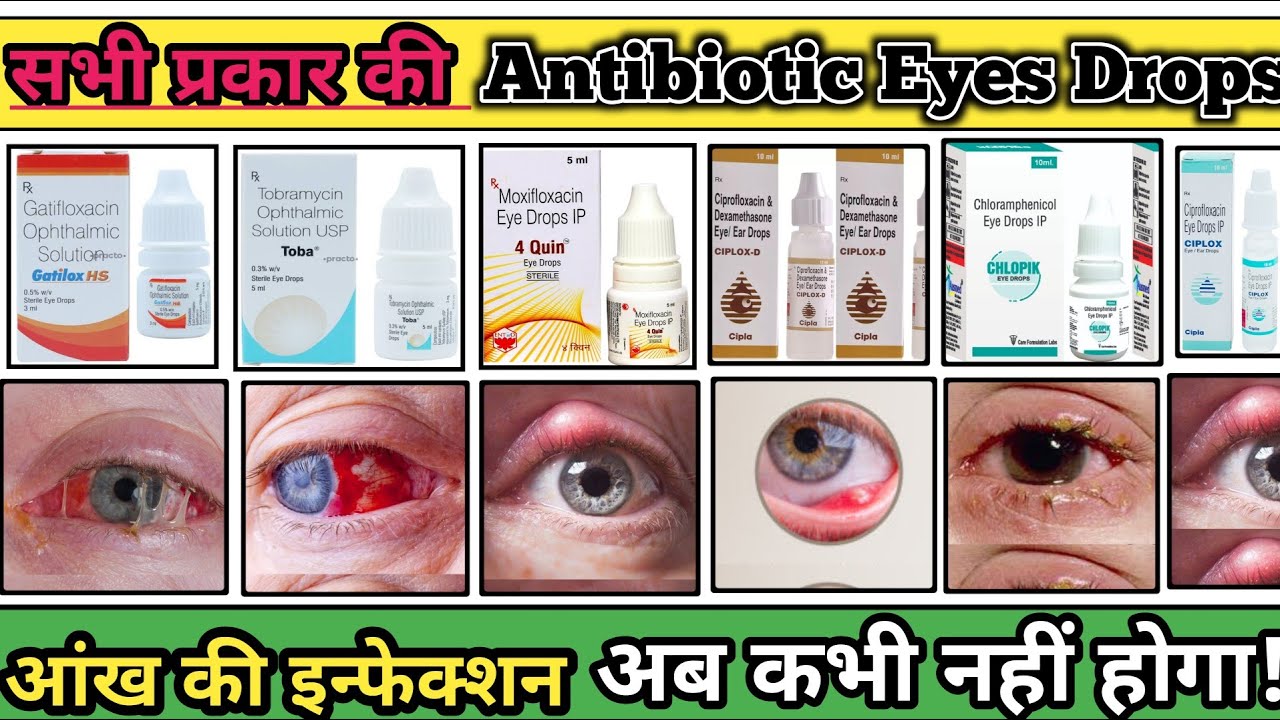 Antibiotic Eyes Drops | Eye Drops | All Drops | Pharmacology | Pharmacy Students | Mbbs Doctor 