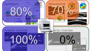 AECOS 2017 presentation by Dan Reinstein on the ArcScan Insight 100