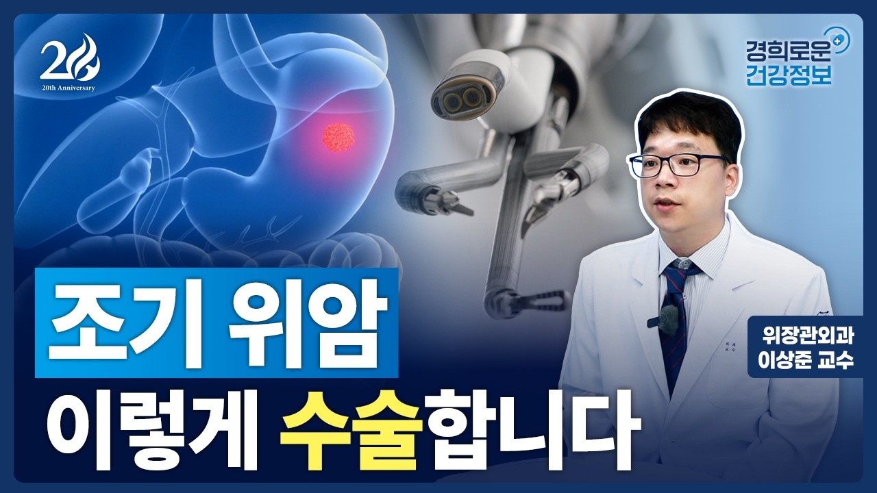 조기 위암은 어떻게 수술할까? [위장관외과 이상준 교수]