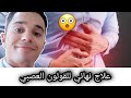 علاج القولون العصبي نهائيا بالاعشاب الطبيعية