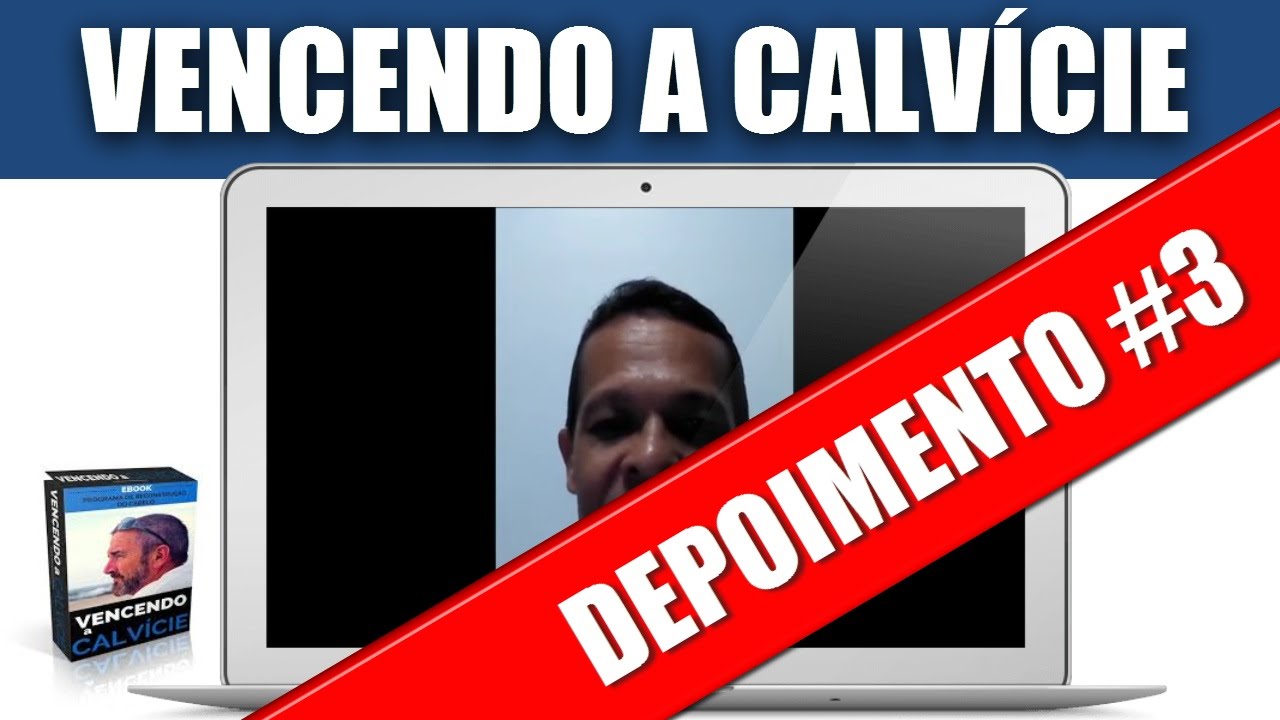 Vencendo A Calvicie Tratamento Para Queda De Cabelo Funciona Depoimento Revela Tudo Queda De Cabelo Tratamento Queda De Cabelo Tratamento