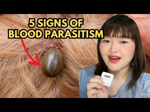 5 SIGNS OF BLOOD PARASITISM