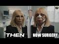 " TOP 8+ HOLLYWOOD ACTORS then  Fame vs now  Surgery " | GLOBAL STAR UPDATES