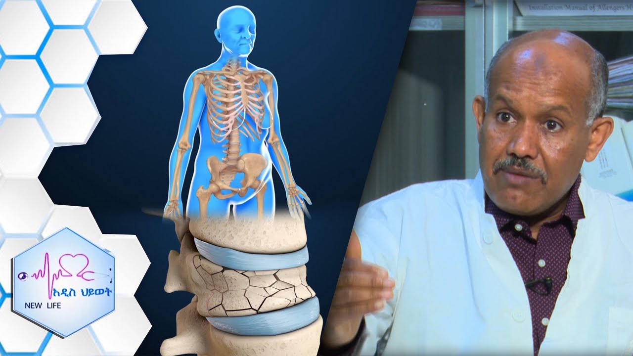 አዲስ ሕይወት ፤ የአጥንት መሳሳት፡  አንድ ሰው አጥንቱ እንዳይሳሳ የግድ አካላዊ እንቅስቃሴ ማድረግ አለበት…የዘርፉ ባለሙያ፡፡