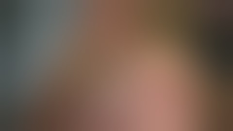 Robotic Total Mesorectal Excision by S  Andrikopoulos, MD