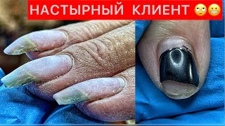 БОЛЬШЕ НЕ ПРИХОДИ СЮДА🤬КЛЮЮЩИЕ И КРИВЫЕ НОГТИ😱😨