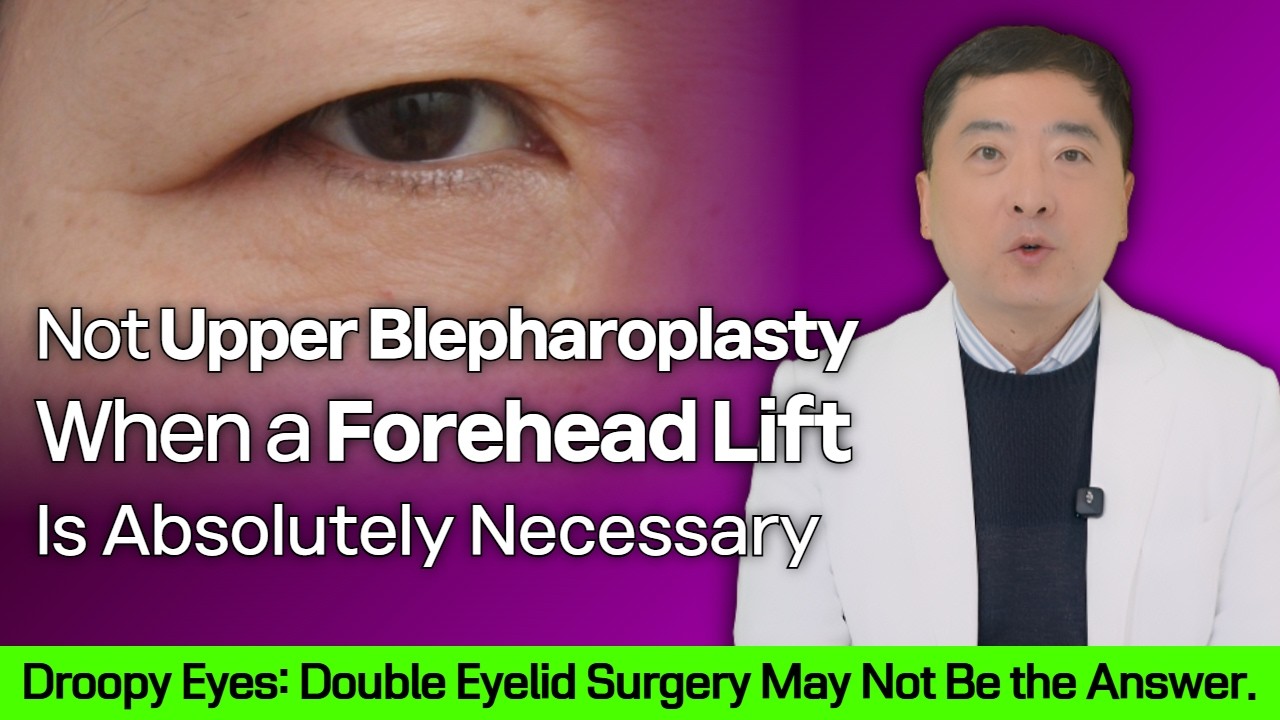 Were You Recommended a Forehead Lift Instead of Eyelid Surgery? Two Cases You’ll Regret Ignoring