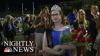 The California Girl Who Can’t Go Out in the Sun Named Homecoming Queen | NBC Nightly News