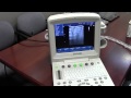 Portable Color Ultrasound - Edan U50