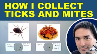 🔬Making Slides of Ticks and Mites TRY2