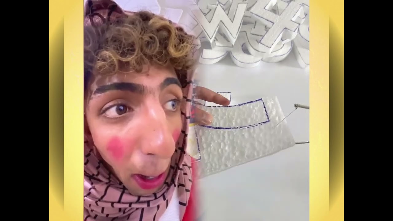 #الطفل الاعمى المعجزه #محضوره_من_الاكسبلور_والمشاهدات #علاوي_مارتن #اكسبلور 15_w(1) 😅