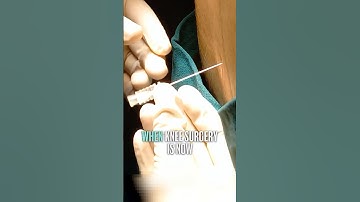SpinE Injection Nerve Block #shorts