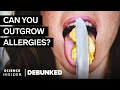Understanding Food Allergies